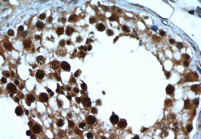 Immunohistochemistry of paraffin-embedded human testis tissue slide using Catalog No:112023(KDM1 Antibody) at dilution of 1:50 (under 40x lens)