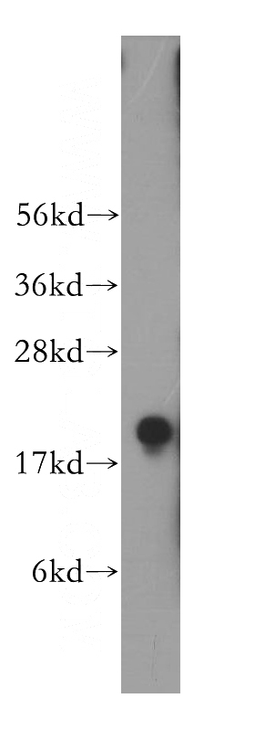 mouse testis tissue were subjected to SDS PAGE followed by western blot with Catalog No:114115(PPP3R2 antibody) at dilution of 1:500