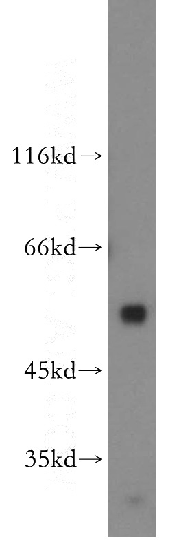 human skeletal muscle tissue were subjected to SDS PAGE followed by western blot with Catalog No:115931(TEAD1 antibody) at dilution of 1:300
