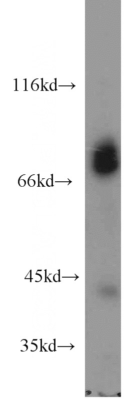 mouse brain tissue were subjected to SDS PAGE followed by western blot with Catalog No:112479(MARK2 antibody) at dilution of 1:1000