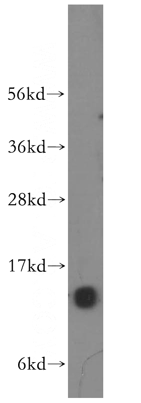 mouse testis tissue were subjected to SDS PAGE followed by western blot with Catalog No:113010(NA14 antibody) at dilution of 1:400