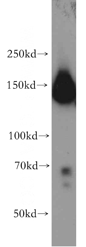 HepG2 cells were subjected to SDS PAGE followed by western blot with Catalog No:110520(FANCI antibody) at dilution of 1:500