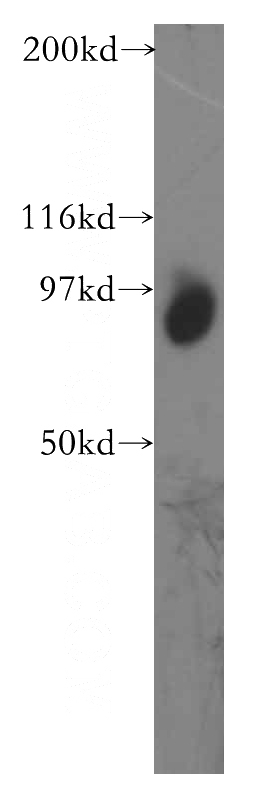 mouse testis tissue were subjected to SDS PAGE followed by western blot with Catalog No:116033(TGS1 antibody) at dilution of 1:400
