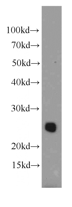 mouse brain tissue were subjected to SDS PAGE followed by western blot with Catalog No:108962(CCDC115 antibody) at dilution of 1:300