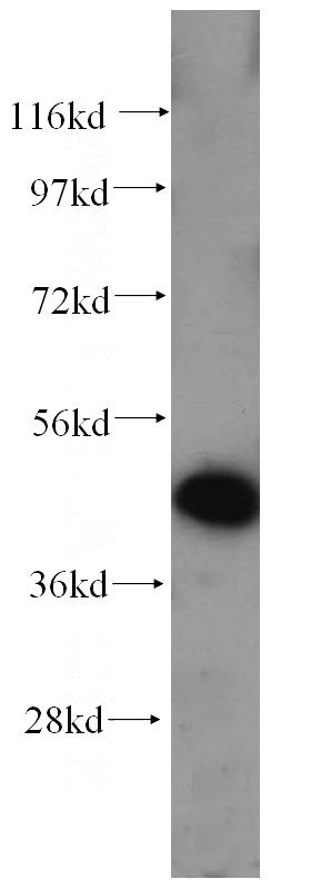 HeLa cells were subjected to SDS PAGE followed by western blot with Catalog No:108865(CSNK1D antibody) at dilution of 1:600