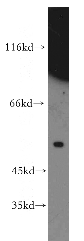 mouse liver tissue were subjected to SDS PAGE followed by western blot with Catalog No:115297(SLC10A3 antibody) at dilution of 1:500