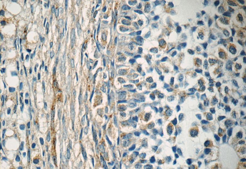 Immunohistochemistry of paraffin-embedded human ovary tissue slide using Catalog No:110182(EIF2B2 Antibody) at dilution of 1:50 (under 40x lens)