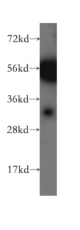 mouse skeletal muscle tissue were subjected to SDS PAGE followed by western blot with Catalog No:108752(CA8 antibody) at dilution of 1:500
