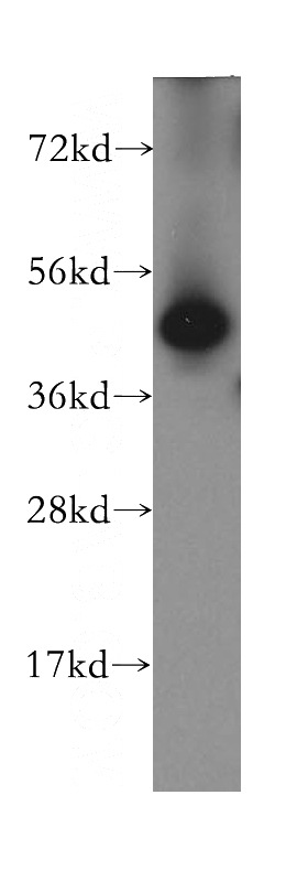 human brain tissue were subjected to SDS PAGE followed by western blot with Catalog No:110065(DPH2 antibody) at dilution of 1:400