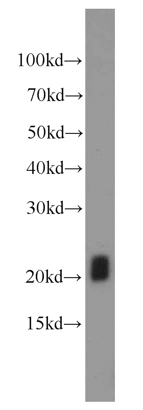 K-562 cells were subjected to SDS PAGE followed by western blot with Catalog No:110825(GAGE2D antibody) at dilution of 1:1000