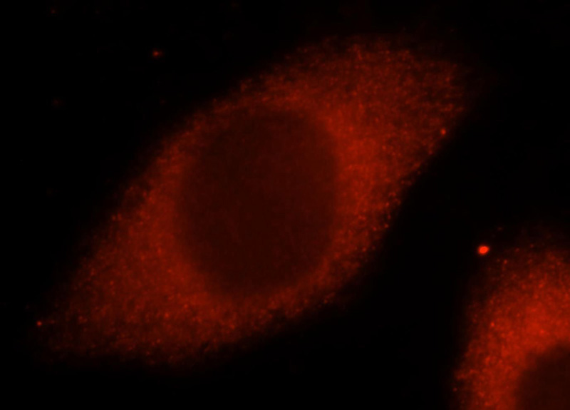 Immunofluorescent analysis of MCF-7 cells, using CARS antibody Catalog No:108863 at 1:25 dilution and Rhodamine-labeled goat anti-rabbit IgG (red).