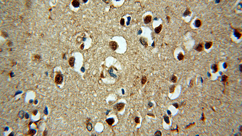 Immunohistochemical of paraffin-embedded human brain using Catalog No:113317(NPAS1 antibody) at dilution of 1:50 (under 40x lens)