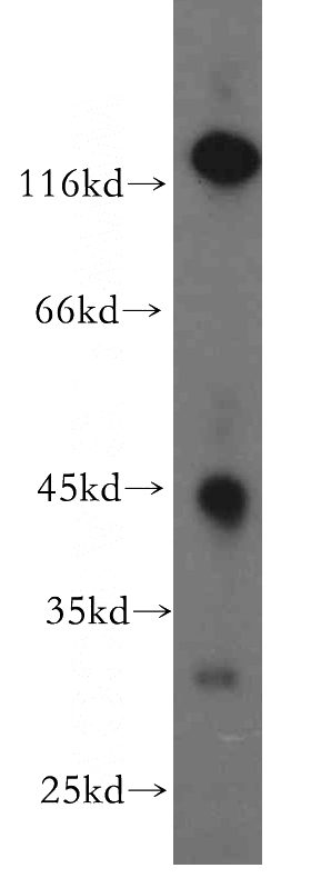 mouse liver tissue were subjected to SDS PAGE followed by western blot with Catalog No:115248(SIRT7 antibody) at dilution of 1:300
