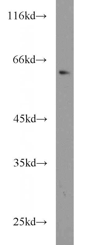 U-937 cells were subjected to SDS PAGE followed by western blot with Catalog No:107808(ABCG4 antibody) at dilution of 1:800