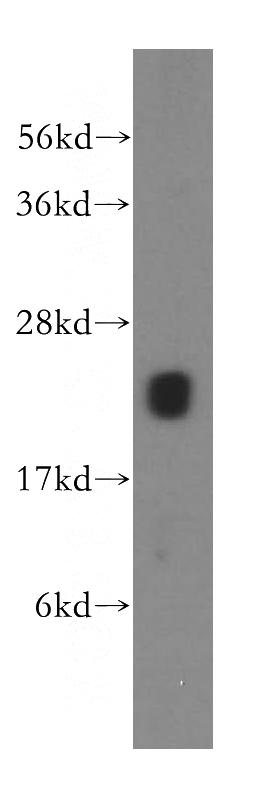 human brain tissue were subjected to SDS PAGE followed by western blot with Catalog No:112839(MRPS10 antibody) at dilution of 1:500