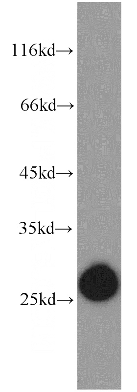 Raji cells were subjected to SDS PAGE followed by western blot with Catalog No:111184(GSTK1 antibody) at dilution of 1:1200