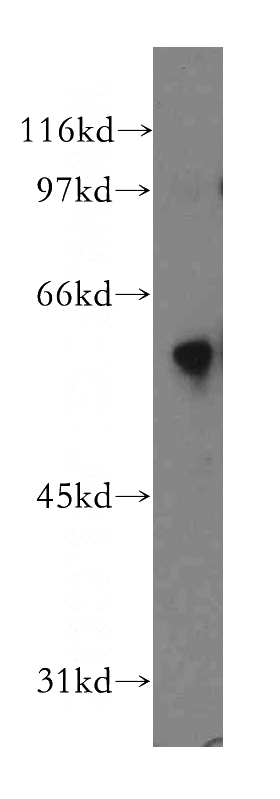 mouse lung tissue were subjected to SDS PAGE followed by western blot with Catalog No:110145(DYRK4 antibody) at dilution of 1:300