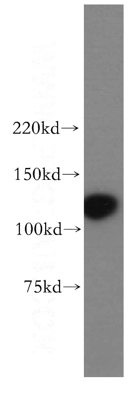 Jurkat cells were subjected to SDS PAGE followed by western blot with Catalog No:113997(POLD1 antibody) at dilution of 1:500