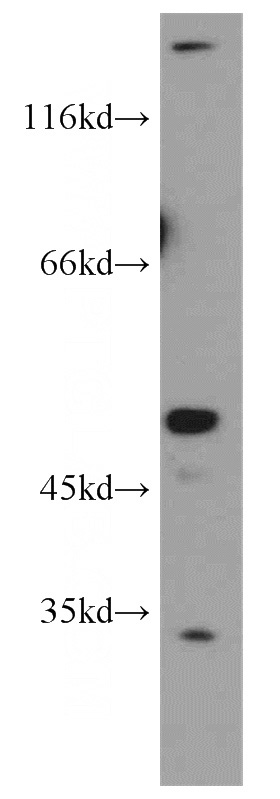 MCF7 cells were subjected to SDS PAGE followed by western blot with Catalog No:116113(THUMPD1 antibody) at dilution of 1:1000