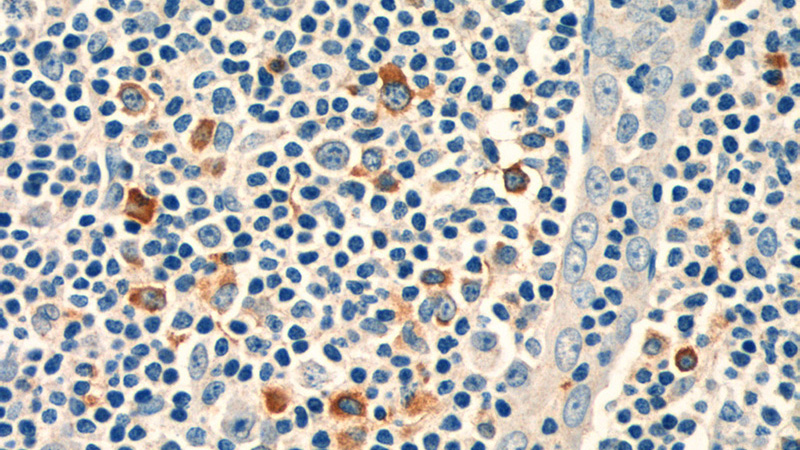 Immunohistochemistry of paraffin-embedded human tonsillitis tissue slide using Catalog No:109014(CD244 Antibody) at dilution of 1:50 (under 40x lens)