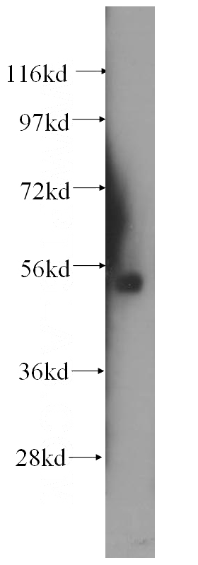human placenta tissue were subjected to SDS PAGE followed by western blot with Catalog No:115599(SRPX2 antibody) at dilution of 1:500