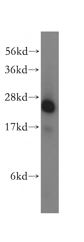 HeLa cells were subjected to SDS PAGE followed by western blot with Catalog No:113228(NQO2 antibody) at dilution of 1:500