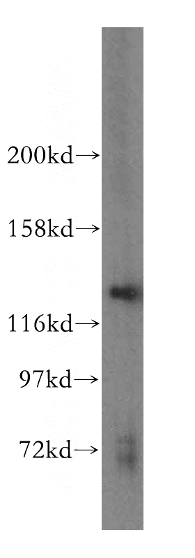HepG2 cells were subjected to SDS PAGE followed by western blot with Catalog No:114049(POLR3B antibody) at dilution of 1:300