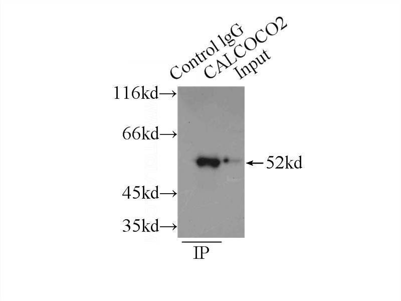IP Result of anti-CALCocO2 (IP:Catalog No:108818, 3ug; Detection:Catalog No:108818 1:1000) with HeLa cells lysate 2150ug.