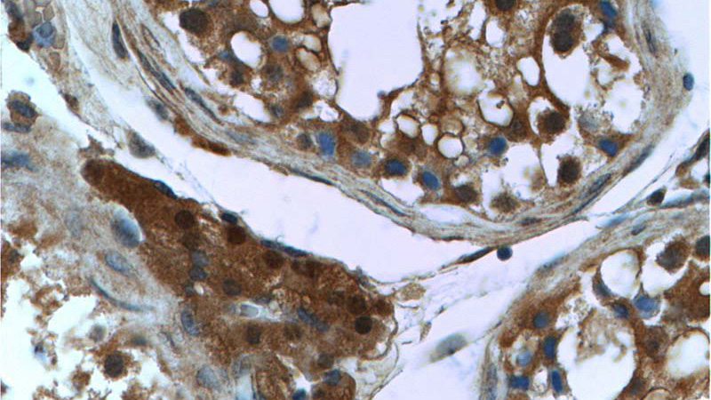 Immunohistochemistry of paraffin-embedded human testis tissue slide using Catalog No:107489(PSMD4 Antibody) at dilution of 1:200 (under 40x lens)
