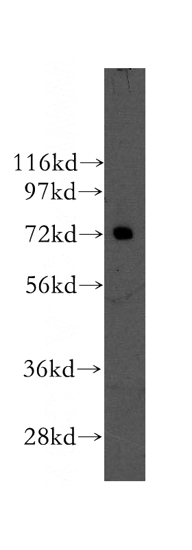 mouse testis tissue were subjected to SDS PAGE followed by western blot with Catalog No:113452(NXF2 antibody) at dilution of 1:400