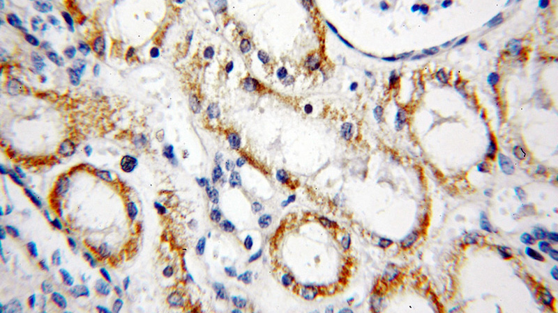 Immunohistochemical of paraffin-embedded human kidney using Catalog No:113402(NUAK2 antibody) at dilution of 1:50 (under 40x lens)