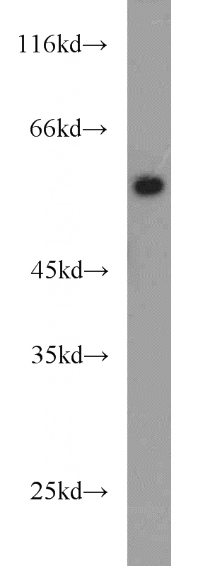 HEK-293 cells were subjected to SDS PAGE followed by western blot with Catalog No:114016(PLVAP antibody) at dilution of 1:800