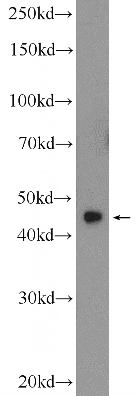 HEK-293 cells were subjected to SDS PAGE followed by western blot with Catalog No:117160(ZNF320 Antibody) at dilution of 1:300