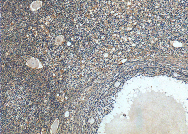 Immunohistochemistry of paraffin-embedded human ovary tissue slide using Catalog No:109715(Cystatin C Antibody) at dilution of 1:200 (under 10x lens).