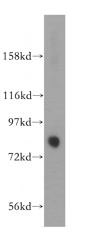 mouse brain tissue were subjected to SDS PAGE followed by western blot with Catalog No:112011(KIF2B antibody) at dilution of 1:1000