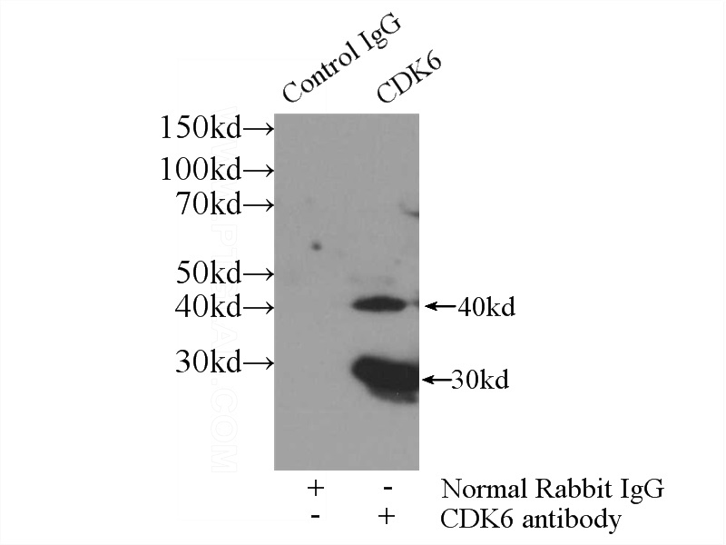 IP Result of anti-CDK6 (IP:Catalog No:109165, 3ug; Detection:Catalog No:109165 1:300) with C6 cells lysate 1600ug.