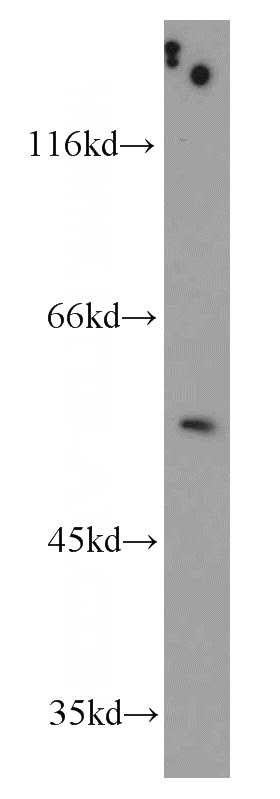 mouse testis tissue were subjected to SDS PAGE followed by western blot with Catalog No:116317(TRIM44 antibody) at dilution of 1:500