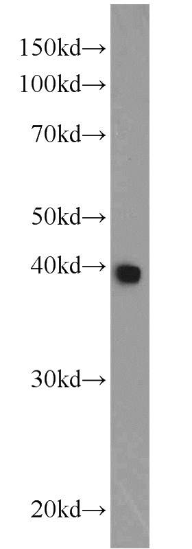 HepG2 cells were subjected to SDS PAGE followed by western blot with Catalog No:109604(CSNK2A2 antibody) at dilution of 1:500