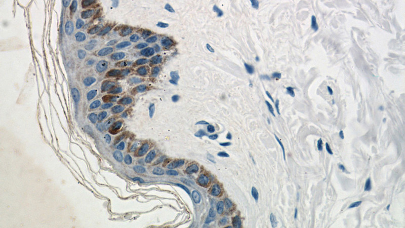 Immunohistochemical of paraffin-embedded human skin using Catalog No:112170(LCE1B antibody) at dilution of 1:50 (under 40x lens)