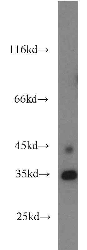 HeLa cells were subjected to SDS PAGE followed by western blot with Catalog No:113379(NUP35 antibody) at dilution of 1:600