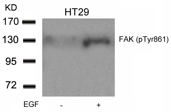 Western blot analysis of extracts from HT29 cells untreated or treated with EGF using FAK (Phospho-Tyr861) Antibody .
