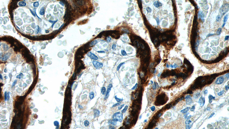Immunohistochemistry of paraffin-embedded human placenta tissue slide using Catalog No:113933(CSH2 Antibody) at dilution of 1:50 (under 40x lens)