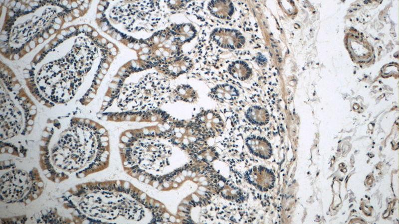 Immunohistochemistry of paraffin-embedded human small intestine tissue slide using Catalog No:114433(RAB34 Antibody) at dilution of 1:50 (under 10x lens)