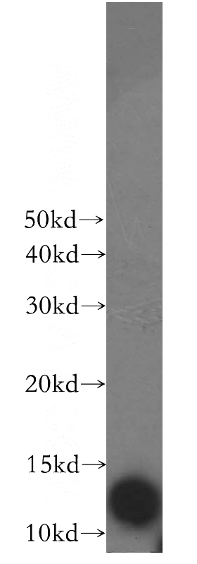 HepG2 cells were subjected to SDS PAGE followed by western blot with Catalog No:114962(S100A5 antibody) at dilution of 1:500