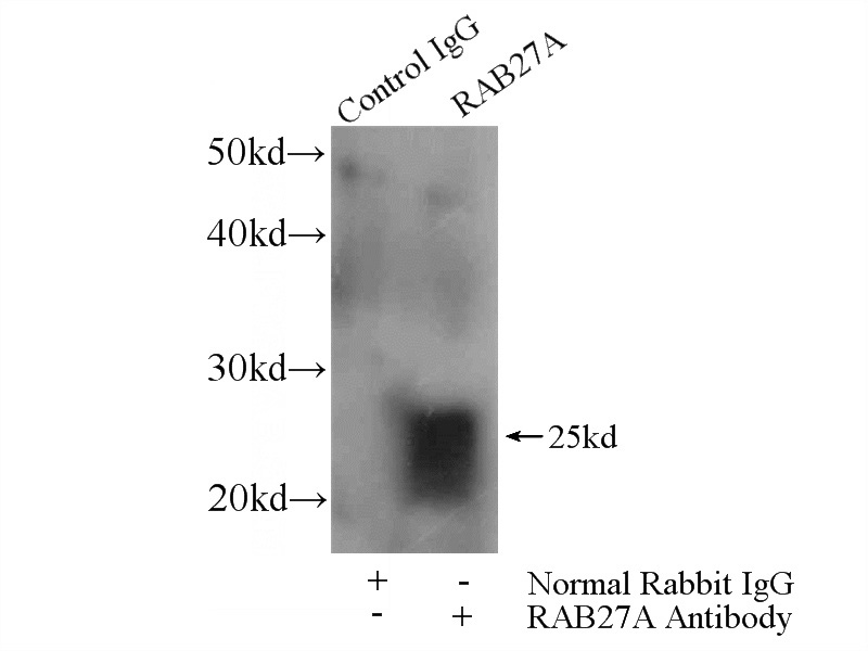 IP Result of anti-RAB27A (IP:Catalog No:114425, 4ug; Detection:Catalog No:114425 1:1000) with K-562 cells lysate 3200ug.