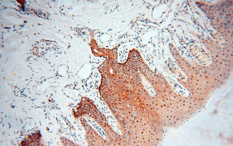 Immunohistochemical of paraffin-embedded human skin using Catalog No:112357(LTA4H antibody) at dilution of 1:100 (under 10x lens)