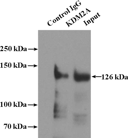 IP Result of anti-KDM2A (IP:Catalog No:112024, 4ug; Detection:Catalog No:112024 1:600) with HeLa cells lysate 1600ug.