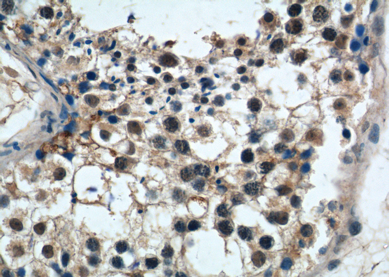 Immunohistochemistry of paraffin-embedded human testis tissue slide using Catalog No:114234(PRPF6 Antibody) at dilution of 1:50 (under 40x lens)
