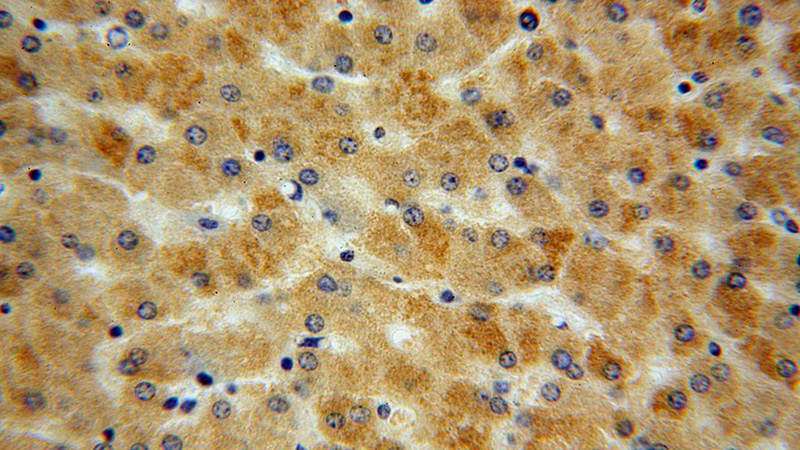 Immunohistochemical of paraffin-embedded human liver using Catalog No:112902(MUT antibody) at dilution of 1:100 (under 40x lens)