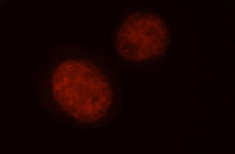 Immunofluorescent analysis of Hela cells, using GTF2I antibody Catalog No:116012 at 1:50 dilution and Rhodamine-labeled goat anti-rabbit IgG (red).